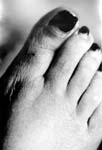 lames de pied